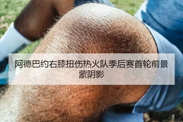 阿德巴约右膝扭伤热火队季后赛首轮前景蒙阴影